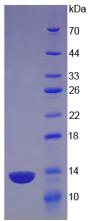 Recombinant Oncostatin M (OSM)