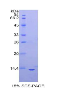 Recombinant Oncostatin M (OSM)