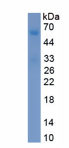 Recombinant Ribonuclease T2 (RNASET2)