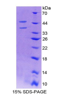 Recombinant Placenta Growth Factor (PLGF)