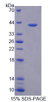 Recombinant Prokineticin 2 (PK2)