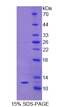 Recombinant Regulated On Activation In Normal T-Cell Expressed And Secreted (RANTES)