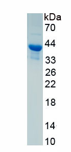 Recombinant Regulated On Activation In Normal T-Cell Expressed And Secreted (RANTES)