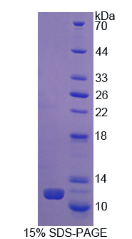 Recombinant Regulated On Activation In Normal T-Cell Expressed And Secreted (RANTES)