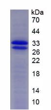 Recombinant Superoxide Dismutase 3, Extracellular (SOD3)