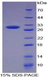 Recombinant Superoxide Dismutase 3, Extracellular (SOD3)