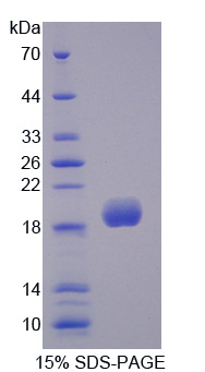 Recombinant Superoxide Dismutase 3, Extracellular (SOD3)