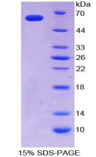 Recombinant Cluster Of Differentiation 40 Ligand (CD40L)