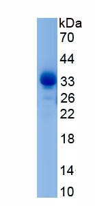 Recombinant Stem Cell Factor (SCF)