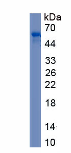 Recombinant Stem Cell Factor Receptor (SCFR)