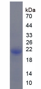 Recombinant Stem Cell Factor Receptor (SCFR)