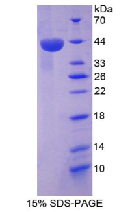 Recombinant Stromal Cell Derived Factor 1 (SDF1)