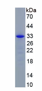 Recombinant Stromal Cell Derived Factor 1 (SDF1)