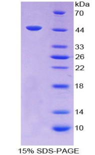 Recombinant Transforming Growth Factor Beta 1 (TGFb1)