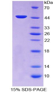 Recombinant Transforming Growth Factor Beta 1 (<b>TGFb1</b>)