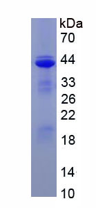 Recombinant Transforming Growth Factor Beta 1 (TGFb1)