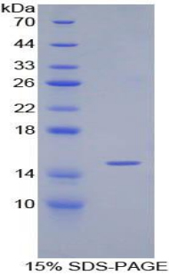 Recombinant Transforming Growth Factor Beta 1 (<b>TGFb1</b>)