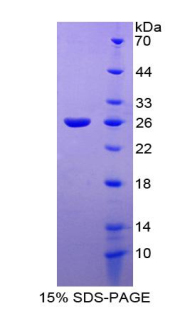 Recombinant Tyrosine Kinase With Immunoglobulin Like And EGF Like Domains Protein 1 (Tie1)