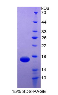 Recombinant TEK Tyrosine Kinase, Endothelial (Tie2)