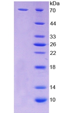 RPA127Hu01.jpg