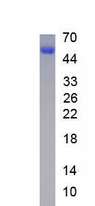 Recombinant Tissue Inhibitors Of Metalloproteinase 2 (TIMP2)