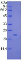 Recombinant Tissue Inhibitors Of Metalloproteinase 2 (TIMP2)