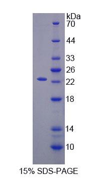 Recombinant Tissue Inhibitors Of Metalloproteinase 2 (TIMP2)