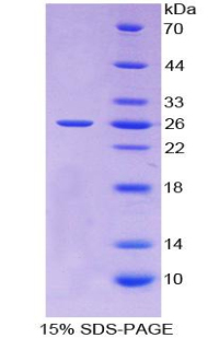 Recombinant Tissue Inhibitors Of Metalloproteinase 3 (TIMP3)