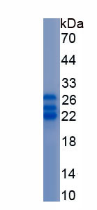 Recombinant Tissue Inhibitors Of Metalloproteinase 3 (TIMP3)