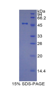 Recombinant Tissue Inhibitors Of Metalloproteinase 4 (TIMP4)