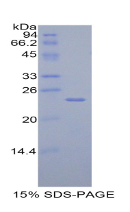 Recombinant Tissue Inhibitors Of Metalloproteinase 4 (TIMP4)