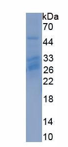 Recombinant Adiponectin Receptor 2 (ADIPOR2)