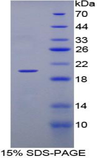 Recombinant Tumor Necrosis Factor Beta (TNFb)