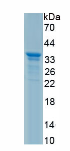 Recombinant Thrombopoietin (TPO)