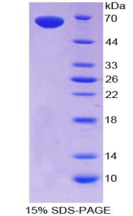 Recombinant Thrombopoietin (TPO)