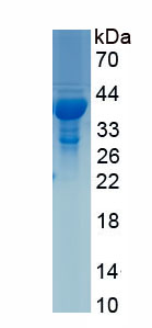 Recombinant Thrombopoietin (TPO)