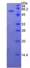 Recombinant Intercellular Adhesion Molecule 5 (ICAM5)