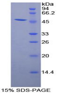 Recombinant Adiponectin Receptor 1 (ADIPOR1)