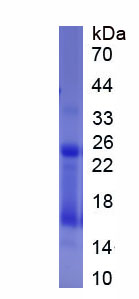 Recombinant Carcinoembryonic Antigen (CEA)