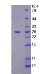 Recombinant Alpha-Fetoprotein (AFP)