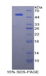 Recombinant Alpha-Fetoprotein (AFP)