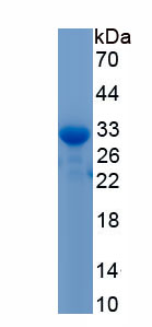 Recombinant Activin AB (ACVAB)