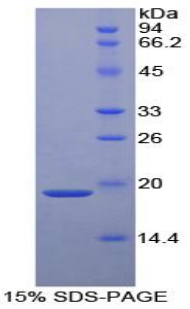 Recombinant Alpha 2-Antiplasmin (a2PI)