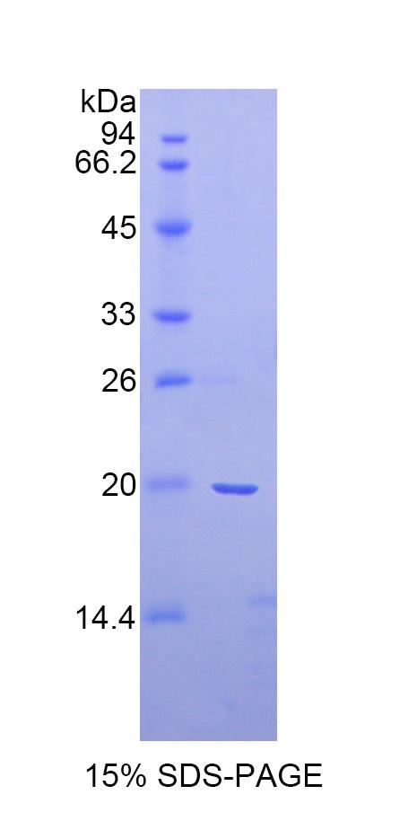 RPA160Ra01.jpg