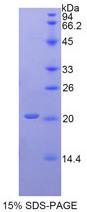 Recombinant Prostatic Acid Phosphatase (PAP)