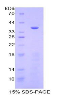 Recombinant Meprin A Alpha (MEP1a)