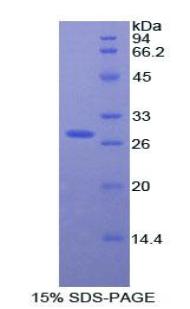 Recombinant Alpha-2-Heremans Schmid Glycoprotein (AHSG)