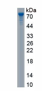 Recombinant Galactosidase Beta (GLb)