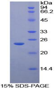 Recombinant Galactosidase Beta (GLb)