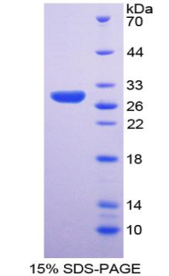 Recombinant Ribonuclease P (RNASEP)